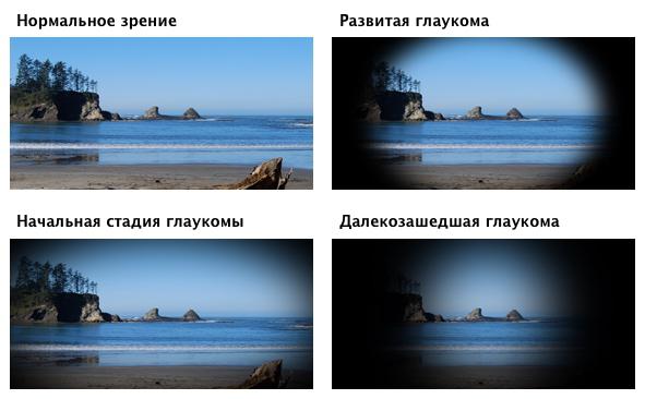 b0f943ead45cb90325d3376a0e0cdb75.jpg b0f943ead45cb90325d3376a0e0cdb75.jpg